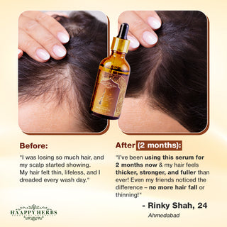 Advance Hair Growth Serum